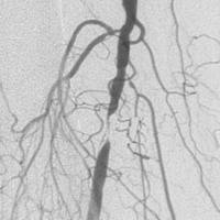 Vascular Health icon